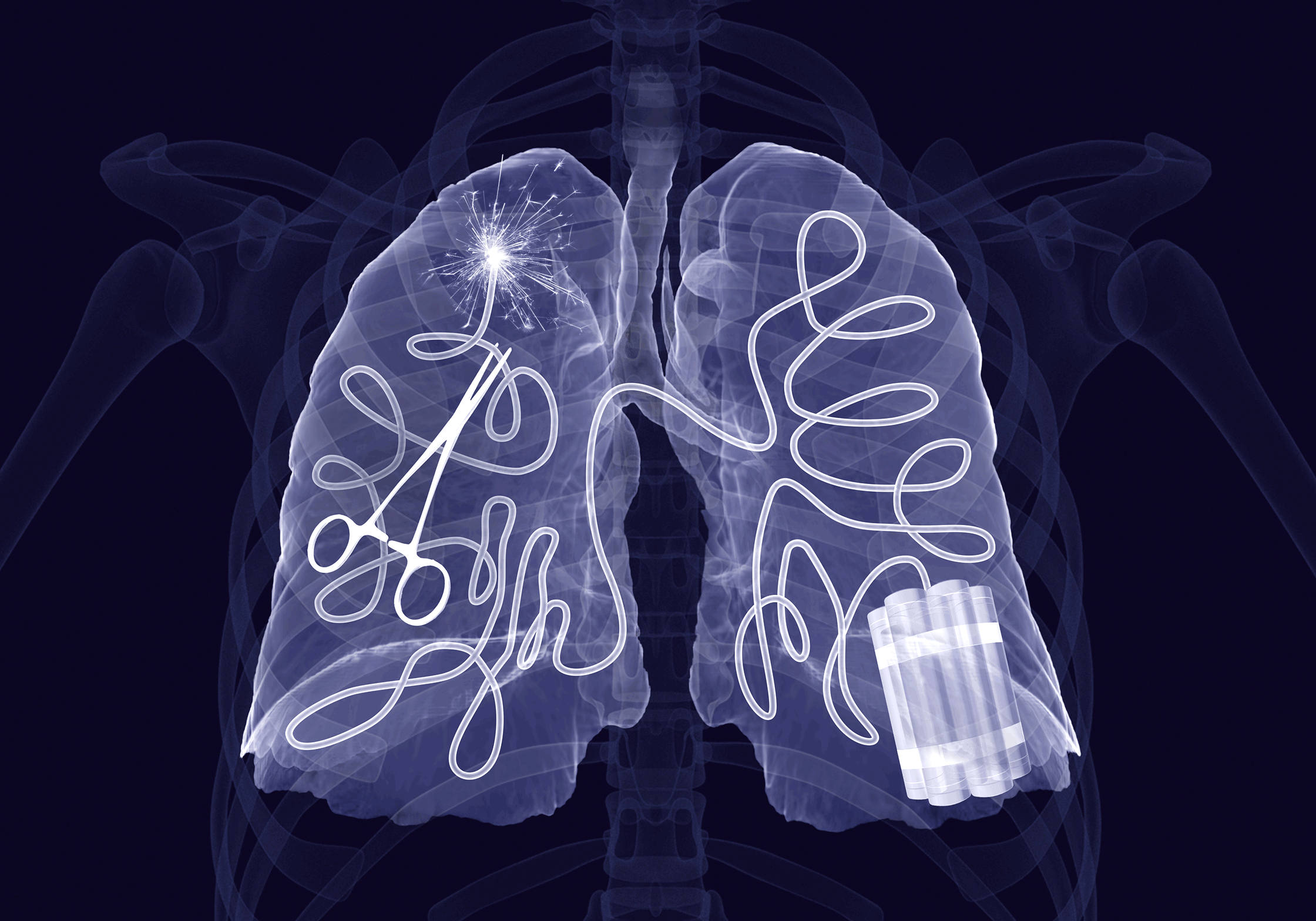 Animated image of human lungs