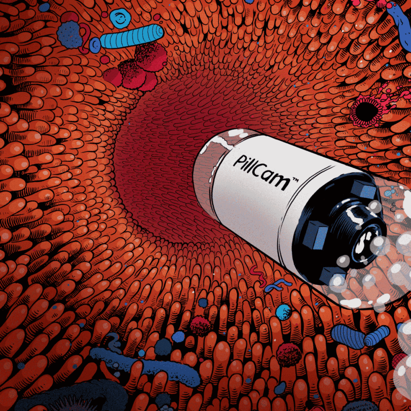 Animated graphic of a camera in pill shape traveling through the body